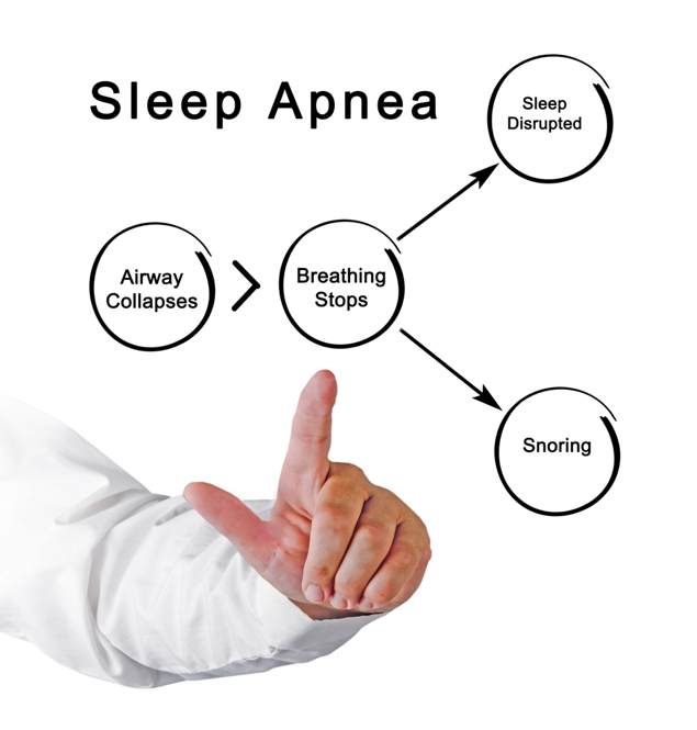 Obstructive sleep apnea disrupts sleep and can leave truck drivers suffering from daytime sleepiness.